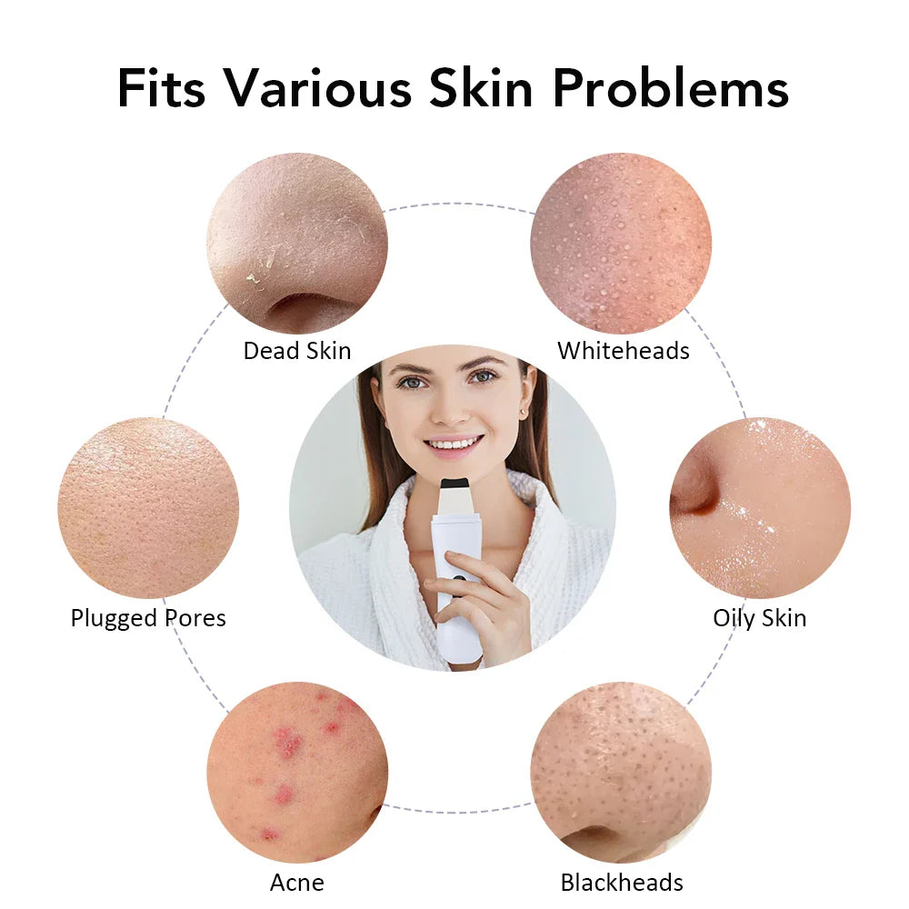 GlowBoost Ultrasonic Skin Scrubber
